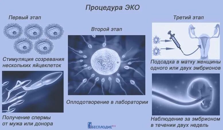 Схема экстракорпорального оплодотворения. Оплодотворение яйцеклетки ИКСИ. Эко это искусственное оплодотворение. Методы искусственного оплодотворения.