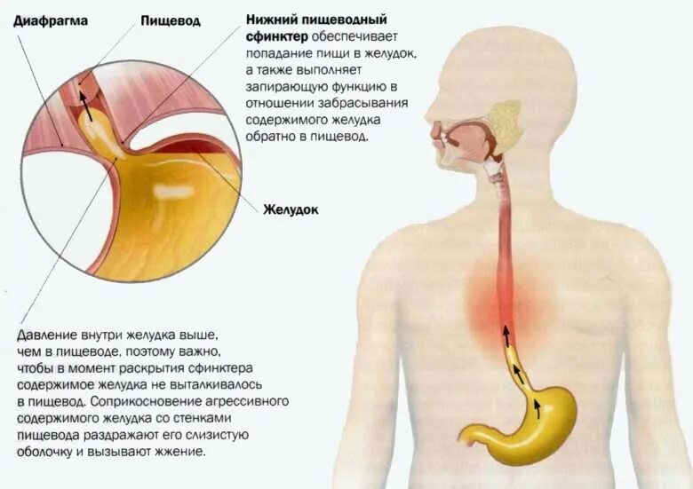 Пищи по пищеводу причины