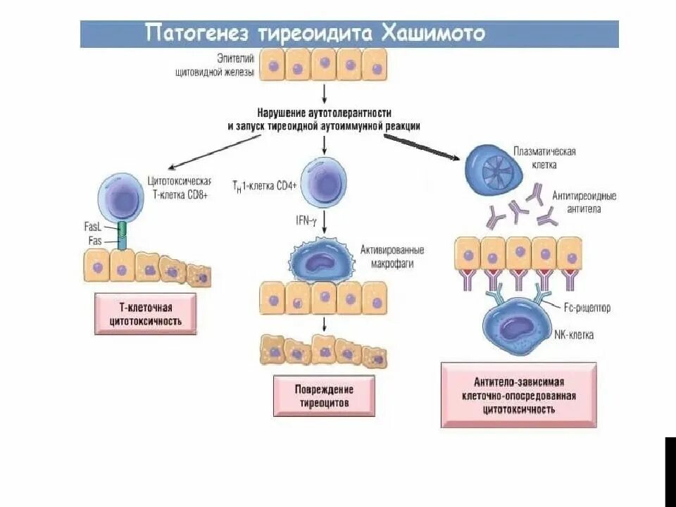 Тиреоидит Хашимото патогенез иммунология. Аутоиммунный тиреоидит этиология патогенез. Зоб Хашимото патогенез. Тиреоидита Хашимото щитовидной железы.