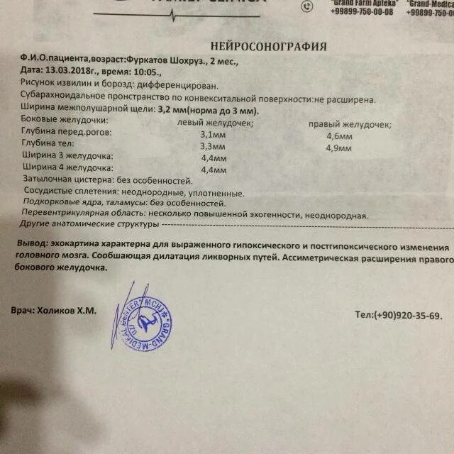 Мпщ сап