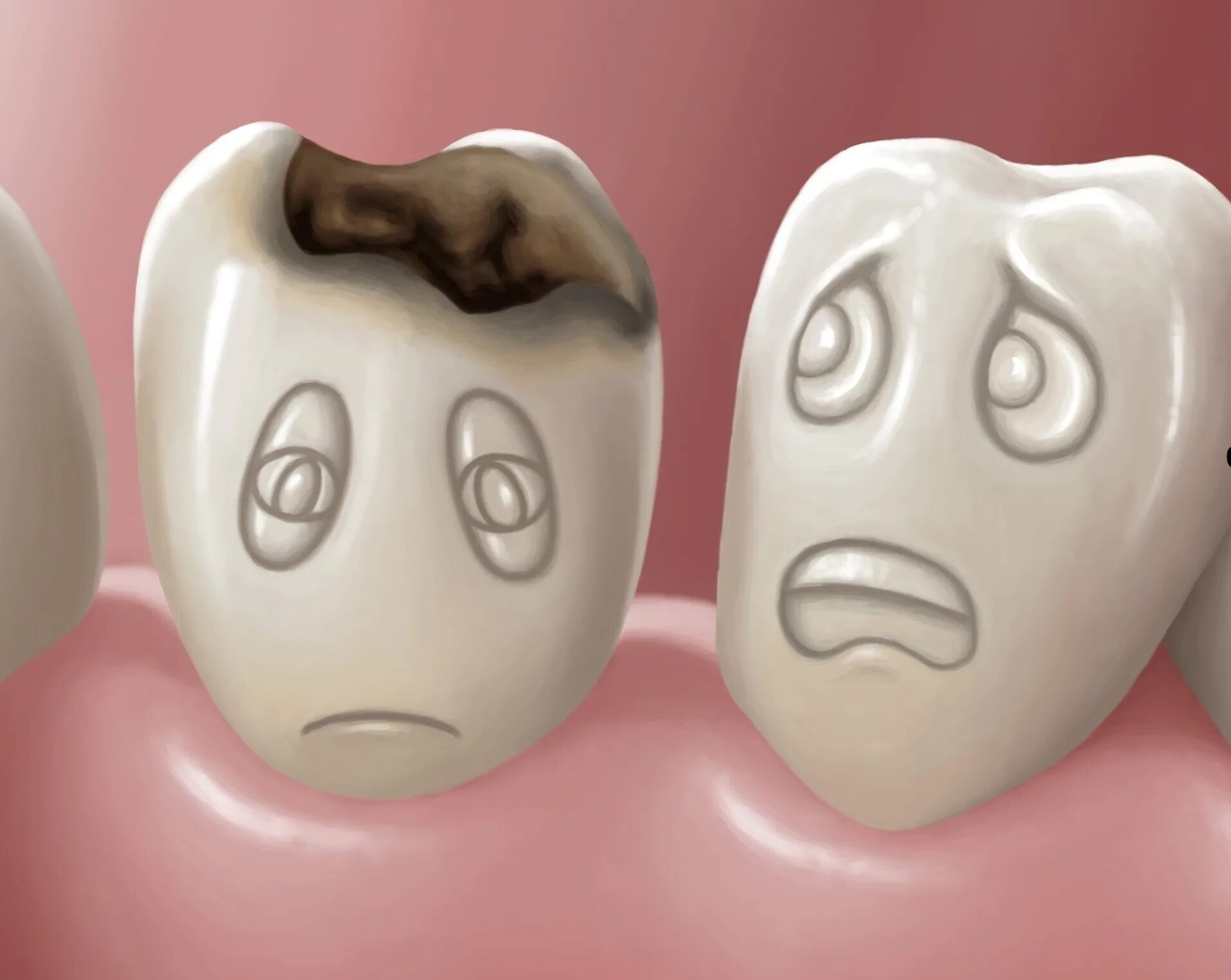 детские зубы с кариесом