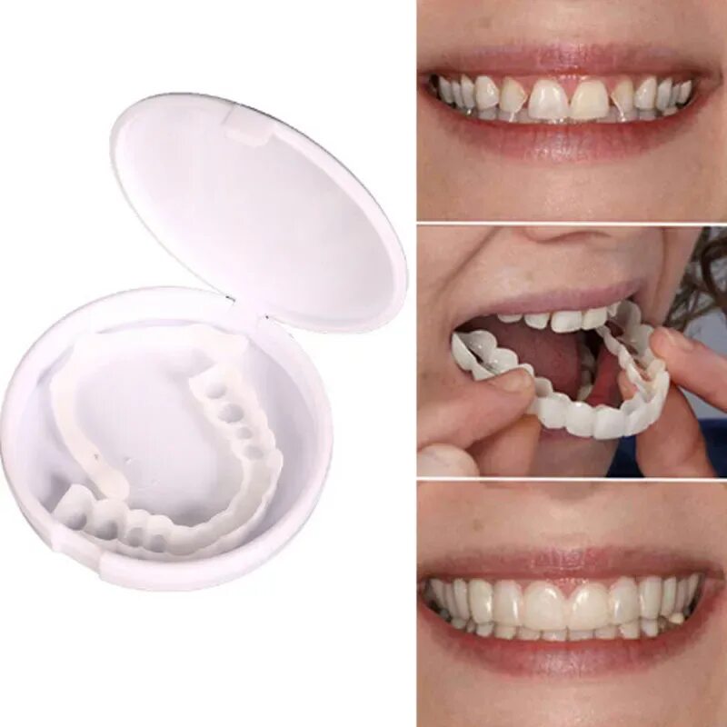 Как правильно одеть зубы виниры. Виниры trusmile veneers. perfect smile veneers накладные виниры. съемные виниры perfect smile veneers.