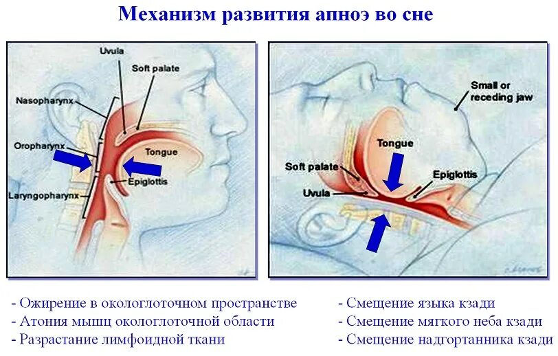 Выбрасывает при засыпании