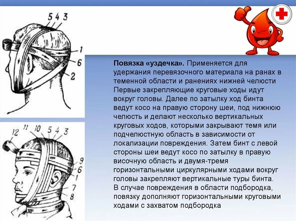 Повязка на теменную область. Повязка на рану в теменной области. Наложение повязки уздечка. Повязка на теменную область головы.