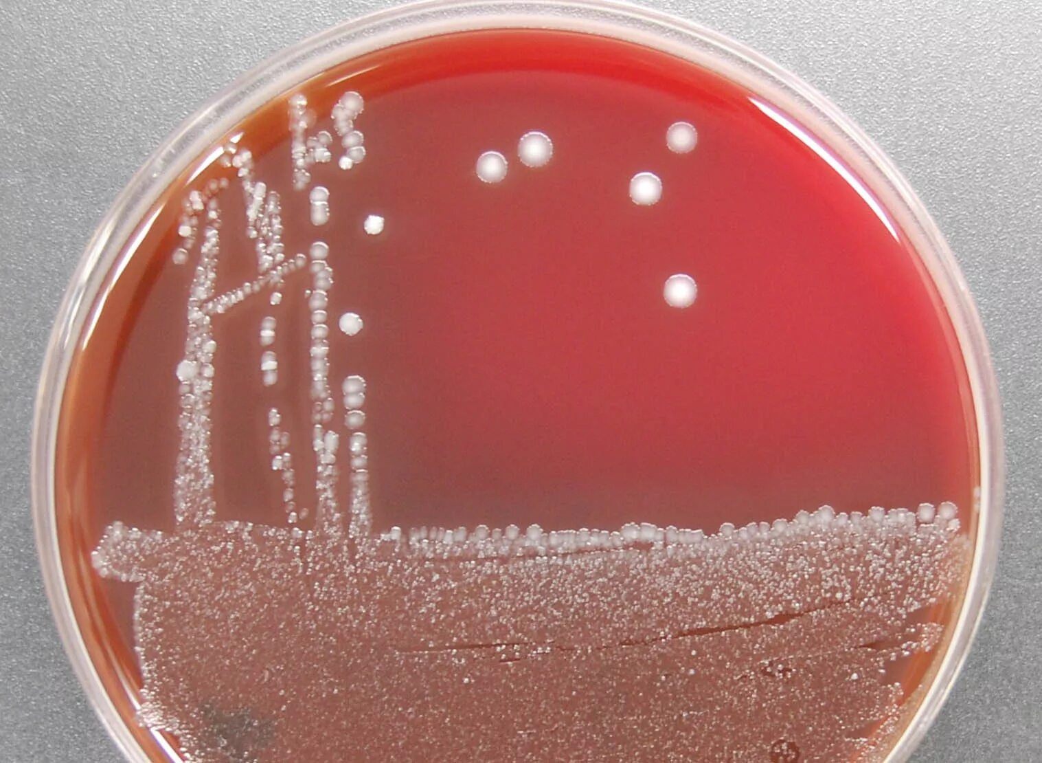 Ба агар. Arcanobacterium haemolyticum. Arcanobacterium haemolyticum рост. Качественный агар. Агар с Гретой кровью.