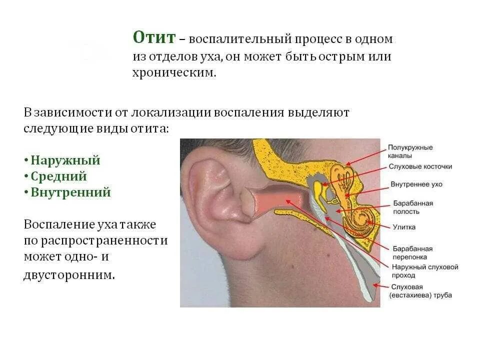 Заболевания наружного. Болезни наружного уха: наружный отит. Средний и наружный отит симптомы. Средний отит и отит наружного уха.