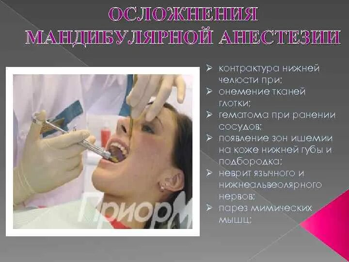 Онемения после анестезии