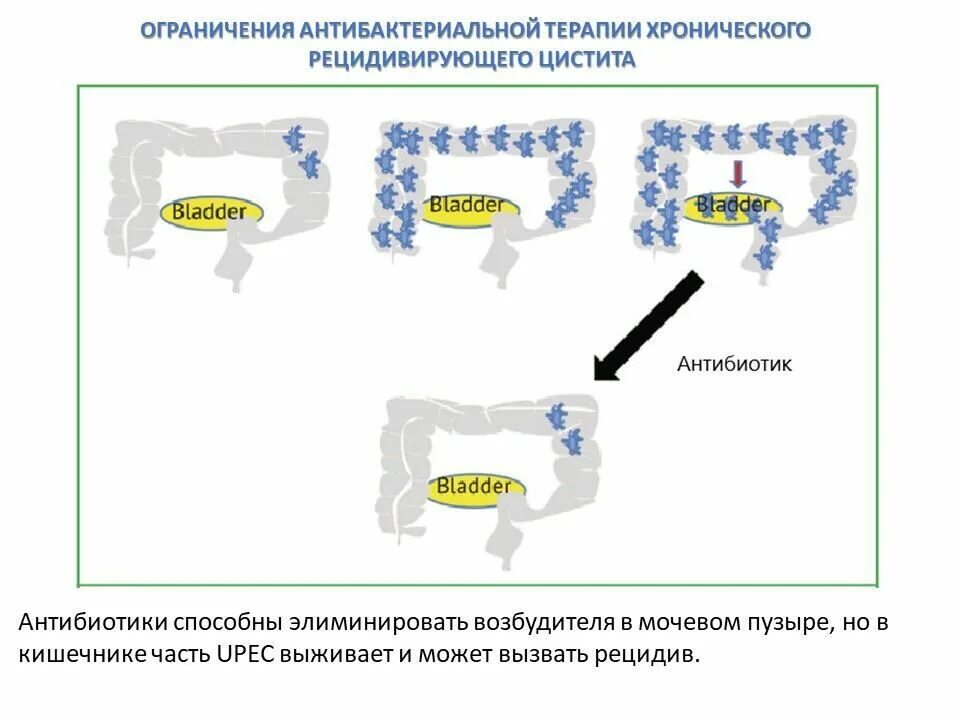 Рецидив цистита. Хронический рецидивирующий цистит. Схема лечения рецидивирующего цистита у женщин. ДЭНАС при цистите у женщин.