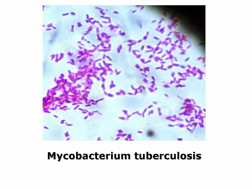 Микобактерии возбудители туберкулеза. Морфология микобактерий туберкулеза. Микобактерии туберкулеза микробиология. Микобактерии туберкулеза микробиология морфология.