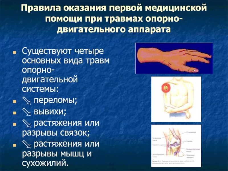 Какова первая помощь при травме. Оказание первой помощи при травмах опорно-двигательного аппарата. Первая помощь при травмах опорно двигательного. Первая помощь при травмах опорнодвигательноц. Первая помощь при повреждении опорно-двигательного аппарата.