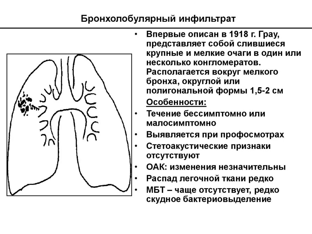 Синдром инфильтрата. Бронхолобулярный инфильтрат рентген. казеозная пневмония рентгенологический синдром. бронхолобулярный инфильтрат (грау). лобулярный инфильтративный туберкулез.