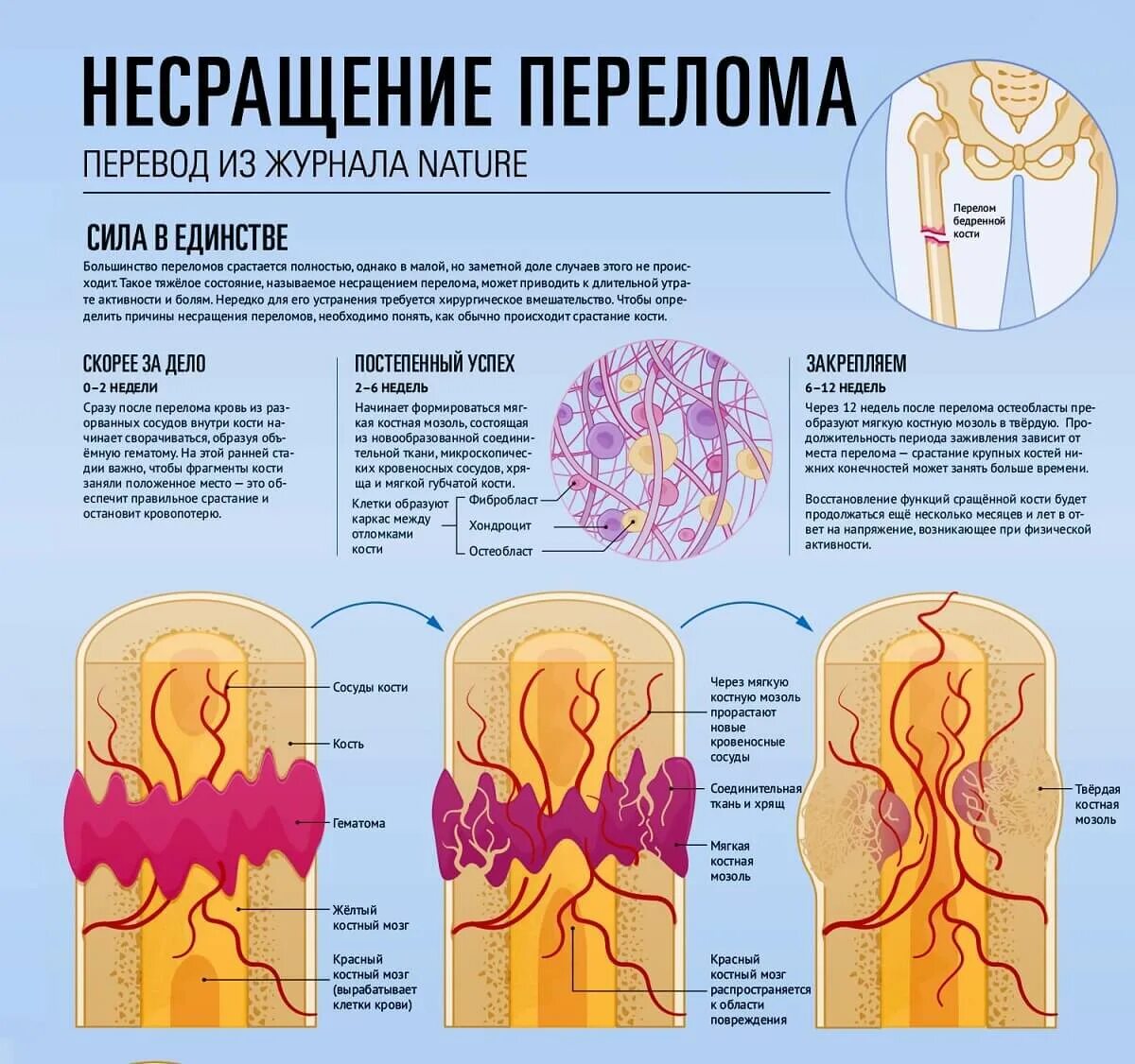 Этапы заживления перелома костей. Фазы заживления переломов костей. Заживление переломов костей стадии.