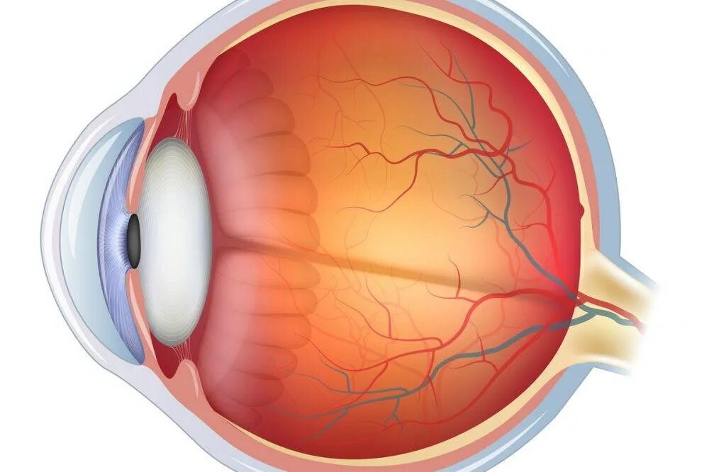 Диабетическая ретинопатия сетчатки глаза. Гипертоническая ангиопатия сетчатки. Диабетическая ангиопатия сетчатки. Периферическая дистрофия сетчатки.
