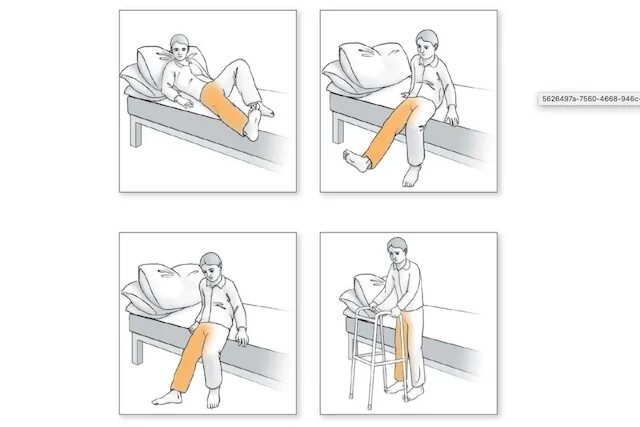 Кровать после операции на тазобедренном. Высота кровати после эндопротезирования тазобедренного сустава. Кровать для реабилитации после операции тазобедренного сустава. Кровать после эндопротезирования тазобедренного сустава. Стул после эндопротезирования тазобедренного сустава.