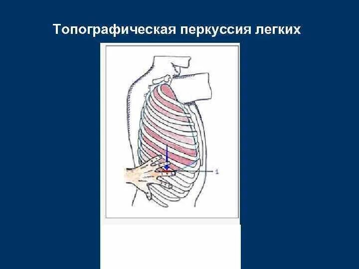 Топографические границы легких. Топографическая перкуссия. Топографическая перкуссия легких. Топографическая перкуссия легких норма. Сравнительная перкуссия органов дыхания.