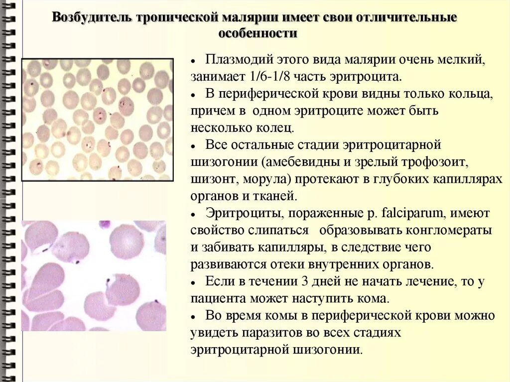 Эритроциты при тропической малярии. Малярия трехдневная морфология. Морфология возбудителя малярии. Возбудитель малярии плазмодий.