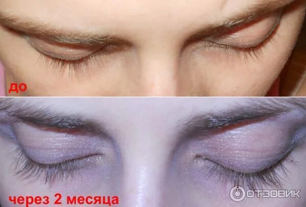 Карепрост до и после отзывы Средство для роста и укрепления ресниц Careprost Bimatoprost Ophthalmic Solution