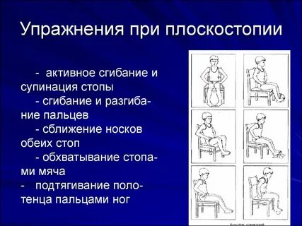 Упражнения для стоп при плоскостопии у взрослых