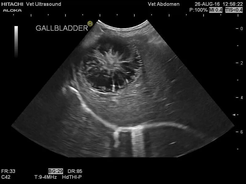 УЗИ желчного пузыря у собаки. Мукоцеле желчного пузыря кт. Мукоцеле желчного пузыря УЗИ. Мукоцеле желчного пузыря у собак.