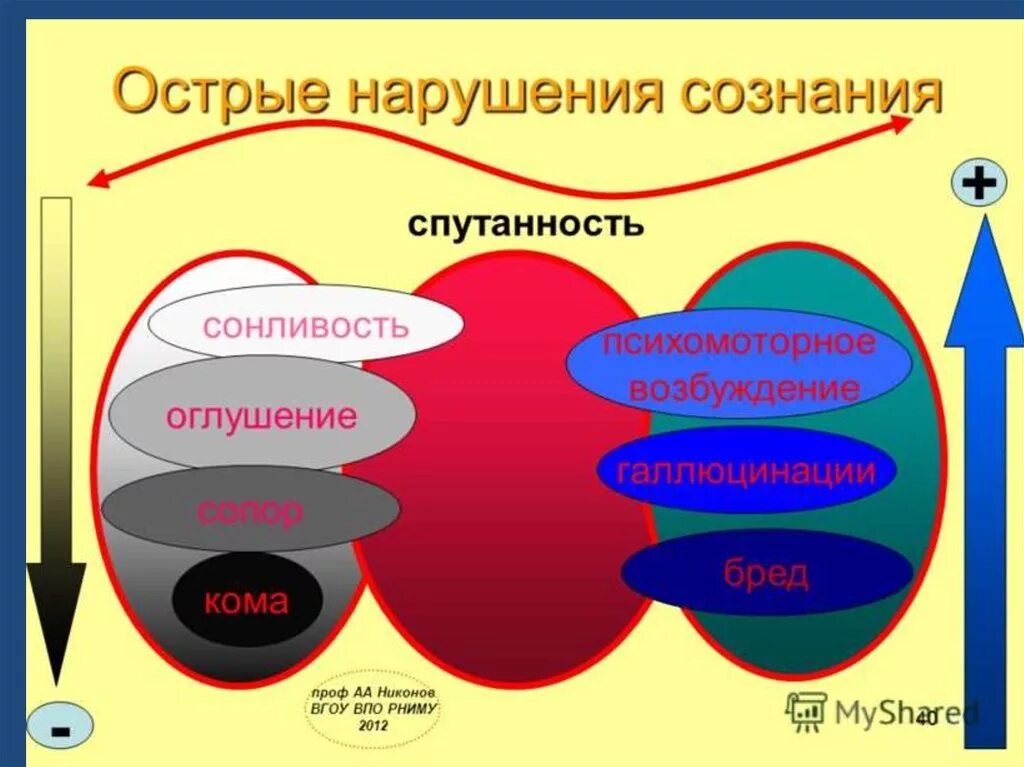 Замедление сознания