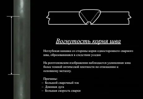 Шов корень