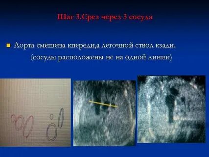 Срез через