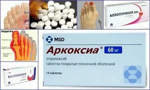 Хорошие уколы от подагры. Противовоспалительные таблетки при подагре. Хорошие уколы от подагры. Хорошие уколы от подагры. Пенсия индивидуальных предпринимателей.