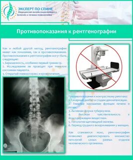 Что едят после рентгена