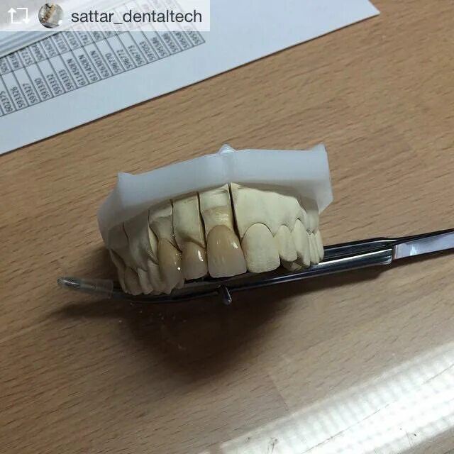 эстетика профессии зубной техник. зубной техник махачкала. апгрейд в махачкале на зубы. зуботехническая лаборатория «метрика». зубной техник махачкала.