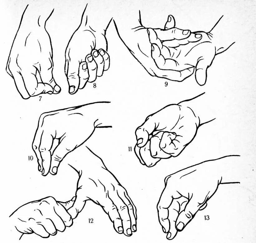 Приемы самомассажа. Гимнастика для кисти руки после инсульта. Самомассаж руки после инсульта. Самомассаж кистей рук и пальцев техника. Массаж рук самомассаж кистей и пальцев рук.