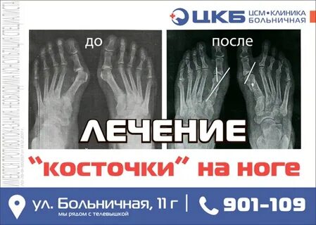 Убери кости