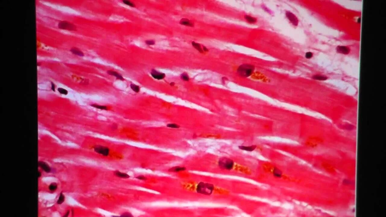 Клетка сердечной поперечно полосатой мышечной ткани. Поперечно полосатая сердечная мышечная ткань микропрепарат. Микропрепарат сердечной мышечной ткани. Гладкая мышечная ткань микрофотография. Гладкая мышечная ткань микропрепарат.