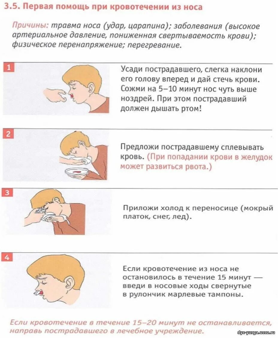 Как остановить сильную кровь. Оказание первой помощи при кровотечении из носа у детей. Памятка при носовом кровотечении у детей. Порядок оказания первой помощи при кровотечении из носа. Ротовое кровотечение первая помощь.