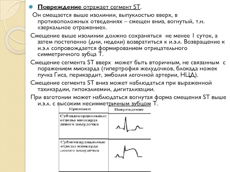 Сегмент смещения. Сегмент смещения