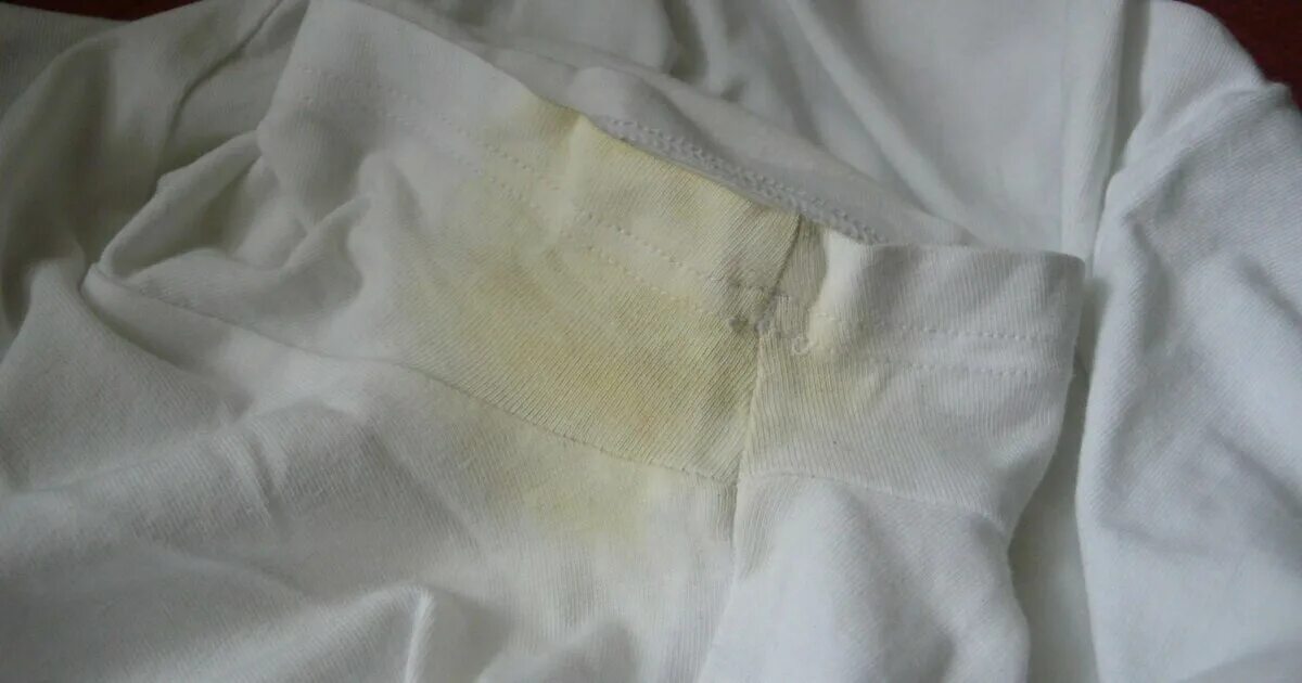 Пятна ржавчины на белой одежде. Отбелить белую футболку с рисунком. Желтые пятна после стирки. Желтые пятна после стирки. Желтые пятна после стирки.