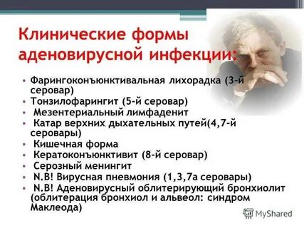Аденовирус глаз