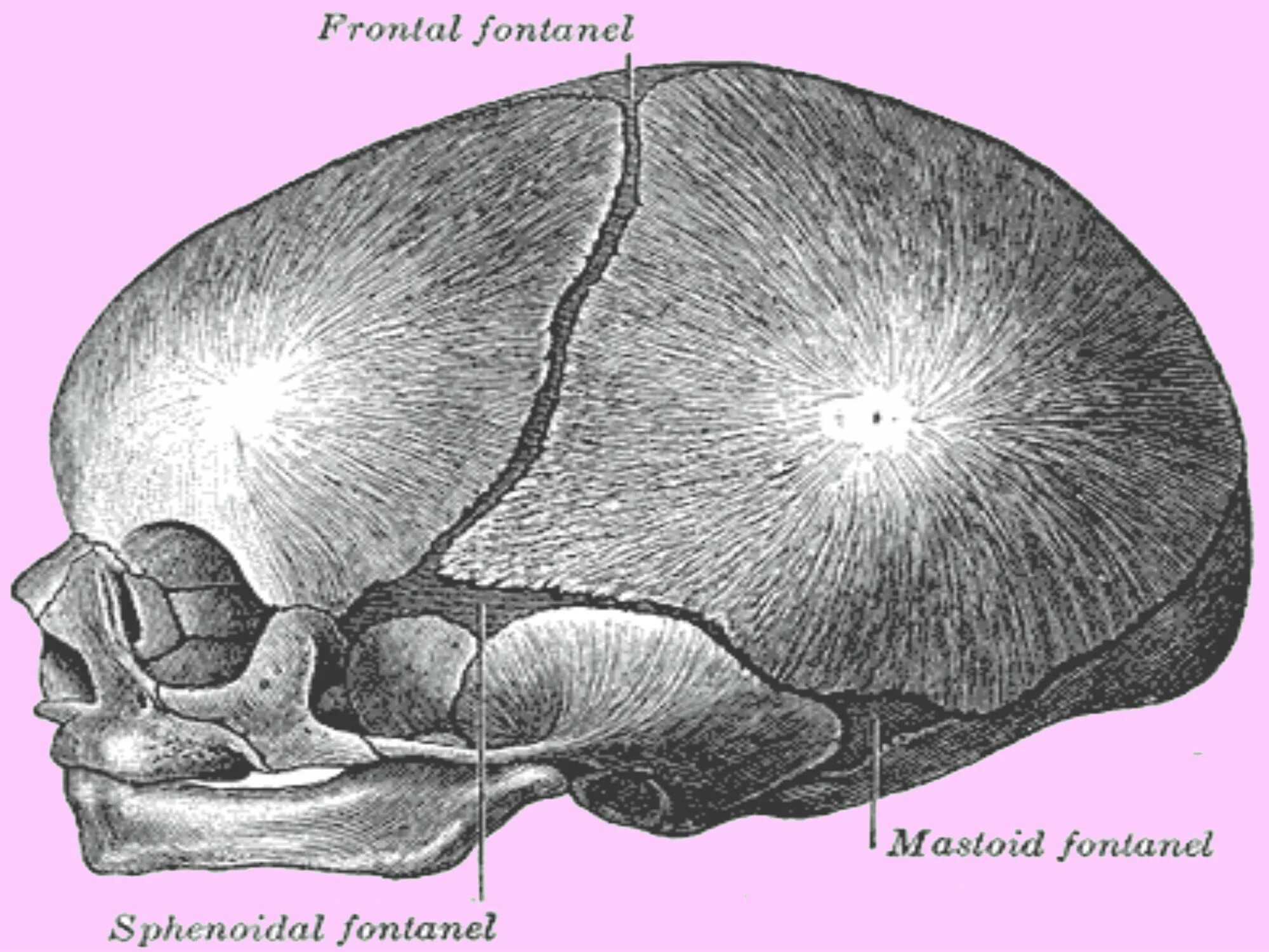 Роднички у новорожденных анатомия. Боковые роднички. Боковые роднички черепа.