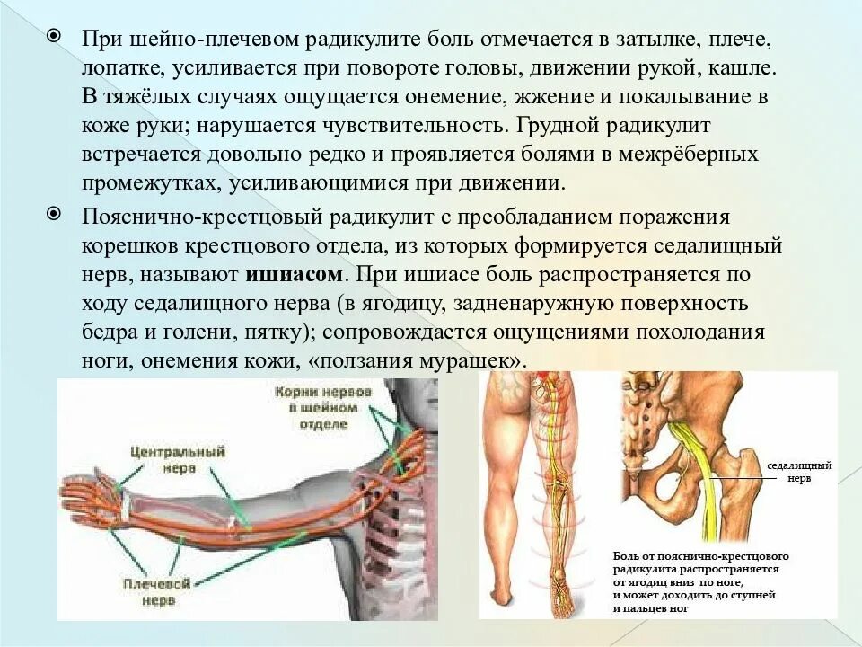 Почему происходит онемение. Шейно плечевой радикулит. Пояснично-крестцовый радикулит. Левая рука отнимается и болит.