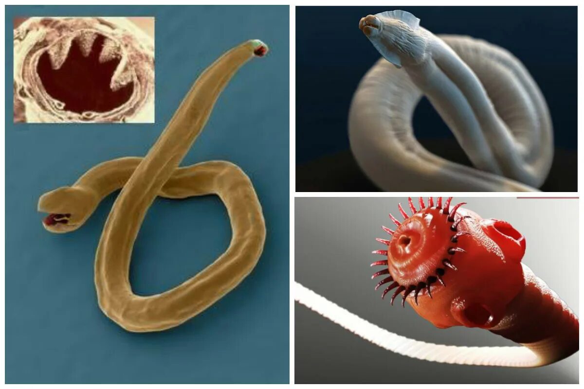 A. аскаридоза и дифиллоботриоза. Гельминты паразитические черви. Черви паразиты Острица. Гельминты паразитические черви у человека.