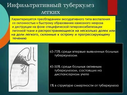 Признаки инфильтративных изменений в легких что