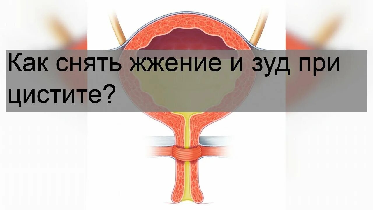 Жжение у мужчины в канале причины. Биопсия мочевого пузыря. Тур биопсия мочевого пузыря мужчин.