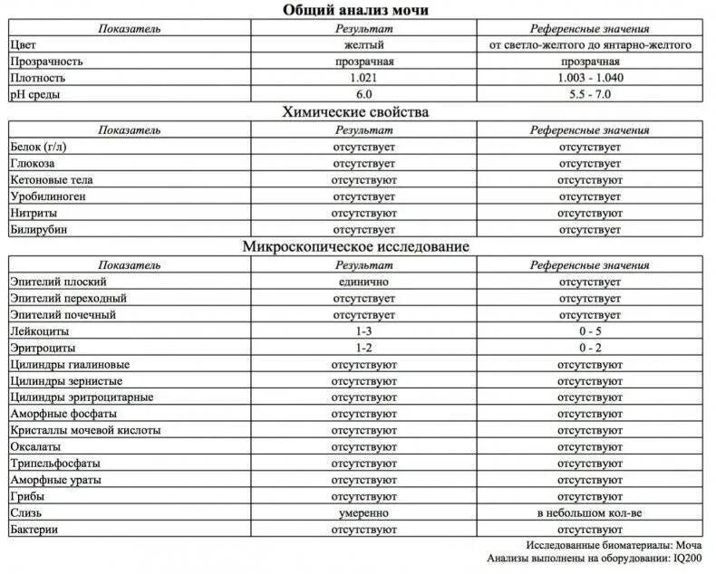 Анализ мочи при месячных. Эпителий плоский в моче норма таблица. общий анализ мочи расшифровка эпителий плоский. общий анализ мочи эпителий норма. нормальные показатели оам у мужчин.