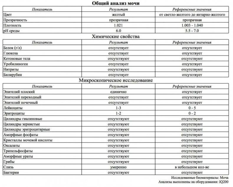 Эпителий плоский в моче норма таблица. Общий анализ мочи расшифровка эпителий плоский. Общий анализ мочи эпителий норма. Нормальные показатели ОАМ У мужчин.