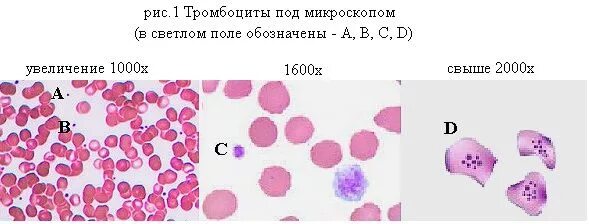 Кровь под микроскопом увеличение Blood Histology Peripheral smear histology slide