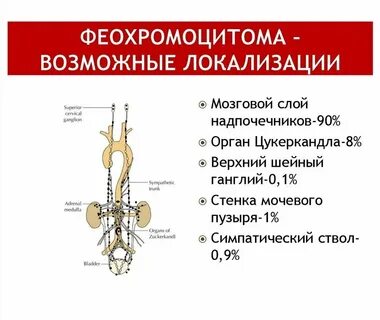 Феохромоцитома