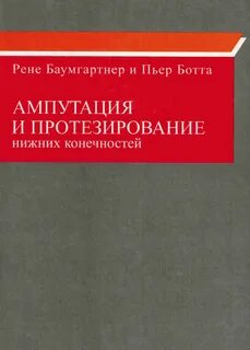 Код ампутации нижних конечностей