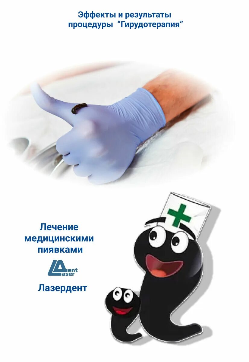 Гирудотерапия визитка. Гирудотерапия показания и противопоказания. Пиявки механизм действия. Гирудотерапия визитка. Показания для постановки пиявок.