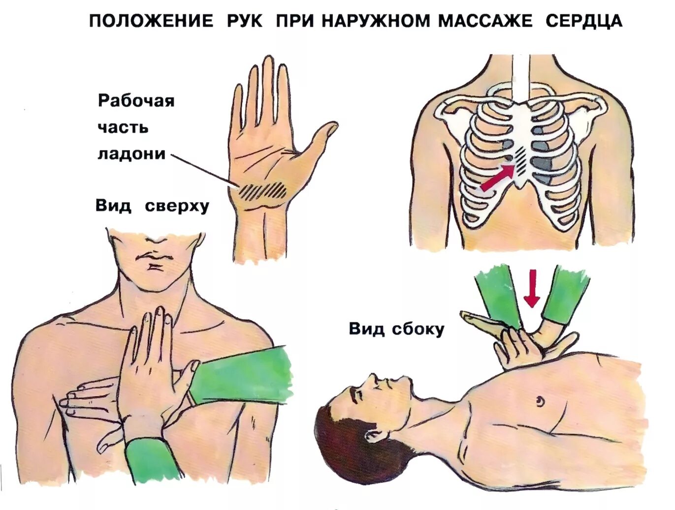 Расположение ладоней при сердечно легочной реанимации. Положение рук при массаже сердца. Расположение рук при непрямом массаже сердца. Наружный непрямой массаж сердца. Местоположение рук