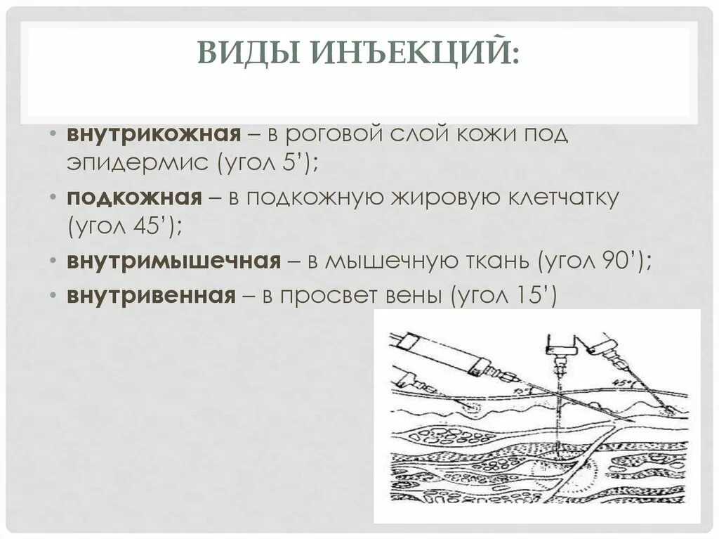 Внутривенно под каким углом. Введение иглы при внутрикожной инъекции. Внутрикожно угол введения иглы. Угол введения иглы при подкожной инъекции. Угол при проведении внутрикожной инъекции.