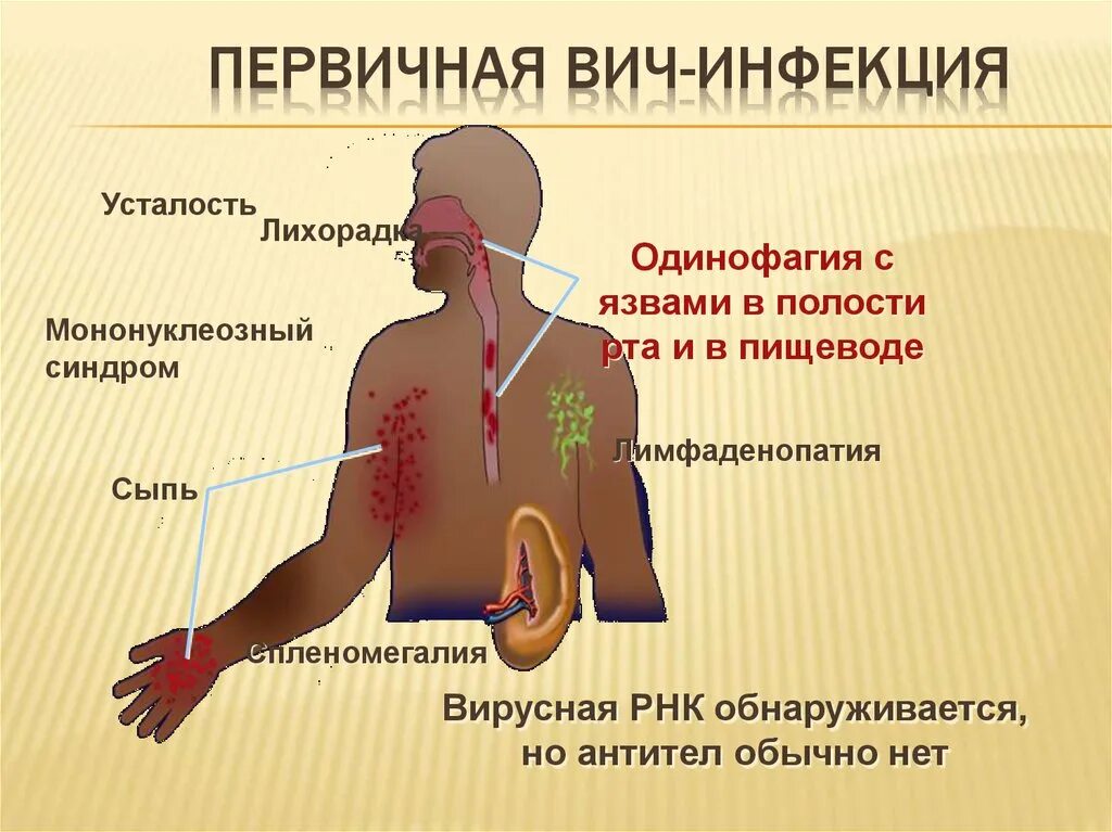 Может ли мужчина болеть. ВИЧ инфекция. Виды инфекций. ВИЧ-инфекция это заболевание. Первичные проявления ВИЧ-инфекции.